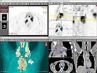 RadiAnt DICOM Viewer 2025.2